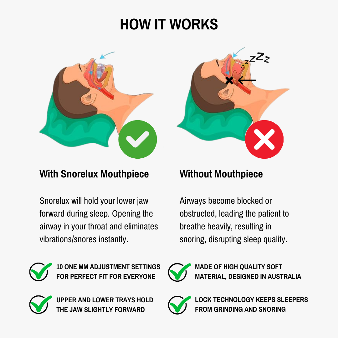 Anti-Snoring Mandibular Device - Snorelux®